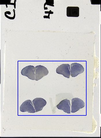 Media type: image; Special Collections 3298   shows specimen_part histological serial section;